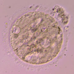 Poor quality oocyte with granular and vacuolated cytoplasm.